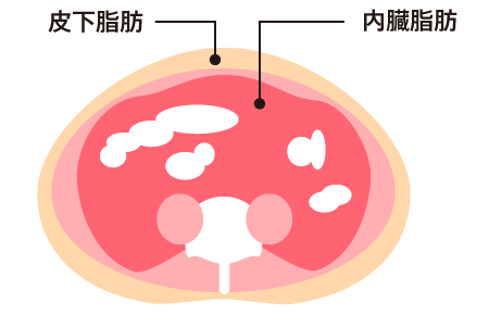 皮下脂肪と内臓脂肪